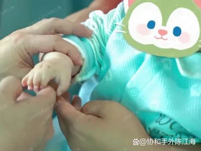 Μην ανησυχείτε για το σύνδρομο Baby's Poland: Είναι ένα ζήτημα, αλλά όχι μεγάλο!